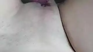 غير محلوق انقسام سرير الجنس